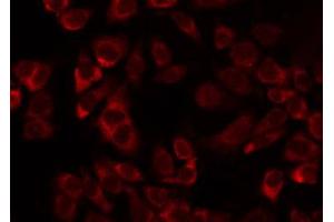ABIN6274727 staining Hela by IF/ICC. (MRPL11 抗体  (Internal Region))