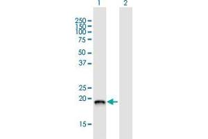 Western Blot analysis of DCTPP1 expression in transfected 293T cell line by DCTPP1 MaxPab polyclonal antibody. (DCTPP1 抗体  (AA 1-170))