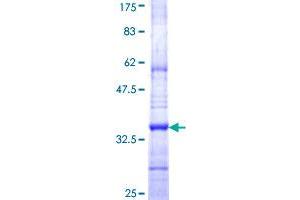 ICMT Protein (AA 86-154) (GST tag)