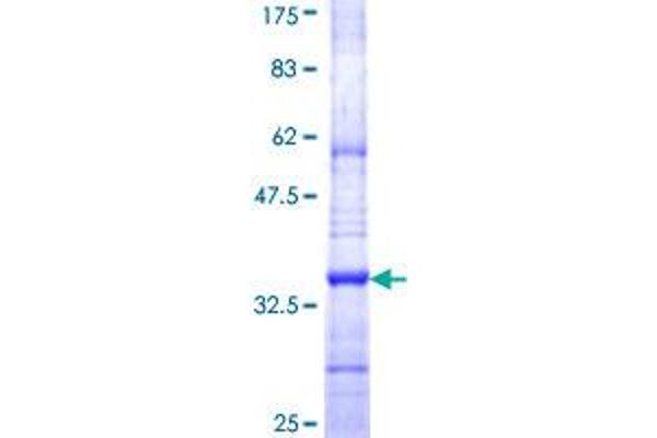 ICMT Protein (AA 86-154) (GST tag)