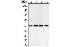Western blot analysis of PLC gamma 2 expression in A549 (A), NIH3T3 (B), mouse brain (C), rat brain (D) whole cell lysates. (Phospholipase C gamma 2 抗体  (Center))
