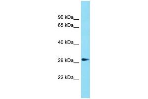 Western Blotting (WB) image for anti-Glycerophosphodiester Phosphodiesterase Domain Containing 1 (GDPD1) (N-Term) antibody (ABIN2791029) (GDPD1 抗体  (N-Term))