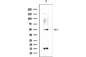 anti-Proline Rich 5 (Renal) (PRR5) antibody