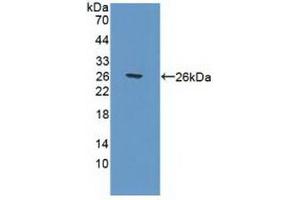Detection of Recombinant POLg1, Human using Polyclonal Antibody to Polymerase DNA Directed Gamma 1 (POLg1) (POLG 抗体  (AA 1041-1239))