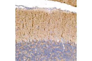 Immunohistochemistry of paraffin-embedded mouse brain using Kallikrein 8 Rabbit mAb (ABIN7268065) at dilution of 1:100 (40x lens). (Kallikrein 8 抗体)