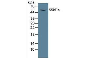 Figure. (CAMK2A 抗体  (AA 1-478))