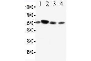 Anti-CD89 antibody, Western blotting Lane 1: A549 Cell Lysate Lane 2: U87 Cell Lysate Lane 3: RAJI Cell Lysate Lane 4: JURKAT Cell Lysate (FCAR 抗体  (AA 84-101))
