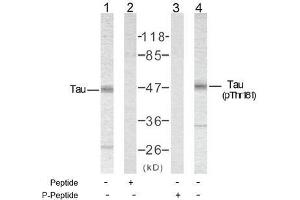 Image no. 2 for anti-Microtubule-Associated Protein tau (MAPT) (pThr181) antibody (ABIN196801) (MAPT 抗体  (pThr181))
