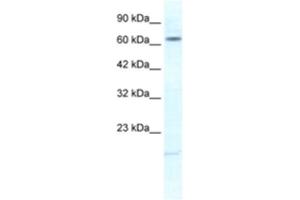 Western Blotting (WB) image for anti-Potassium Voltage-Gated Channel, Subfamily H (Eag-Related), Member 6 (KCNH6) antibody (ABIN2461136)