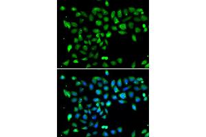 Immunofluorescence analysis of U20S cell using DYRK2 antibody.