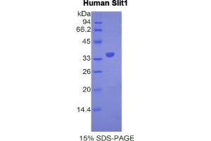 SDS-PAGE analysis of Human Slit Homolog 1 Protein. (SLIT1 蛋白)