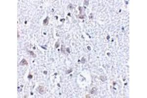 Immunohistochemistry of BRSK1 in human brain tissue with BRSK1 antibody at 2. (BRSK1 抗体  (C-Term))