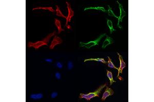 ABIN6259853 and ABIN6266930 staining Hela by IF/ICC.