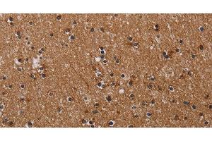 Immunohistochemistry of paraffin-embedded Human brain tissue using CLDND1 Polyclonal Antibody at dilution 1:40 (CLDND1 抗体)