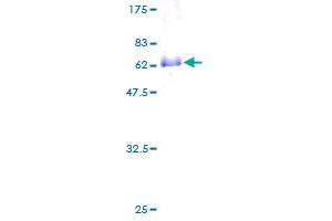DLX2 Protein (AA 1-328) (GST tag)