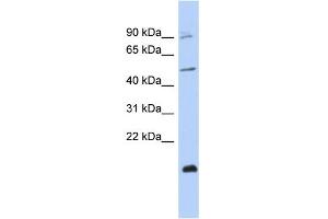 WB Suggested Anti-ZNF645 Antibody Titration:  0. (ZNF645 抗体  (Middle Region))