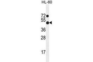 ADA Antibody (C-term) western blot analysis in HL-60 cell line lysates (35 µg/lane). (ADA 抗体  (C-Term))