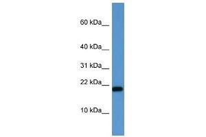 SH2D1A antibody (70R-10049) used at 0. (SH2D1A 抗体  (C-Term))