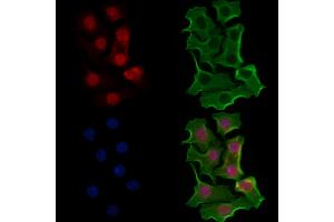 ABIN6257683 and ABIN6274587 staining Hela cells by IF/ICC. (Apoptosis Inhibitor 5 抗体  (C-Term))