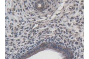 Immunohistochemistry (IHC) image for anti-Matrix Metallopeptidase 9 (Gelatinase B, 92kDa Gelatinase, 92kDa Type IV Collagenase) (MMP9) (AA 226-391) antibody (ABIN7427384)