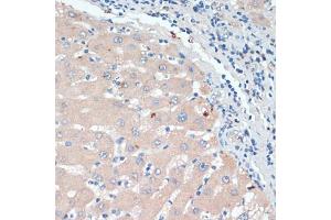 Immunohistochemistry of paraffin-embedded human liver using DBH antibody (ABIN6130337, ABIN6139418, ABIN6139419 and ABIN6218164) at dilution of 1:200 (40x lens). (DBH 抗体  (AA 388-617))