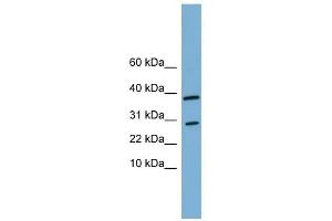 VNN3 antibody used at 1 ug/ml to detect target protein. (VNN3 抗体  (N-Term))