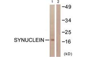 Western blot analysis of extracts from HuvEc cells, using Synuclein (Ab-129) Antibody. (Synuclein 抗体  (AA 91-140))