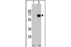 Western blot analysis of CKK2 (arrow) using rabbit polyclonal CKK2 Antibody (C-term) (ABIN1882069 and ABIN2841278). (CAMKK2 抗体  (C-Term))