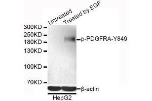 Western blot analysis of extracts of HepG2 cells, using Phospho-PDGFRA-Y849 antibody. (PDGFRA 抗体  (pTyr849))