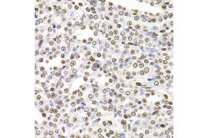 Immunohistochemistry of paraffin-embedded rat kidney using SOX5 antibody (ABIN5974201) at dilution of 1/100 (40x lens). (SOX5 抗体)