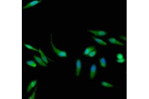 Immunofluorescence staining of Hela cells with ABIN7154629 at 1:133, counter-stained with DAPI. (K-RAS 抗体  (AA 2-168))