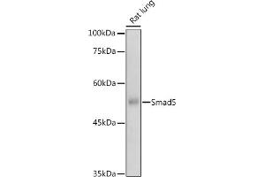 Western blot analysis of extracts of Rat lung, using Smad5 antibody (ABIN1682808, ABIN5663732, ABIN5663734 and ABIN6213914) at 1:500 dilution. (SMAD5 抗体  (AA 140-240))