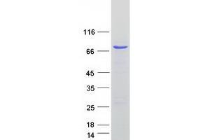 Western Blotting (WB) image for CDK5 Regulatory Subunit Associated Protein 3 (CDK5RAP3) protein (Myc-DYKDDDDK Tag) (ABIN2713867)