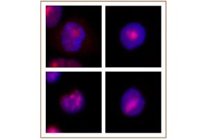 WRN antibody (mAb) tested by Immunofluorescence. (RECQL2 抗体)