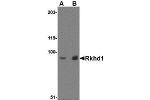 Image no. 1 for anti-Mex-3 Homolog D (MEX3D) (Internal Region) antibody (ABIN341677) (MEX3D 抗体  (Internal Region))