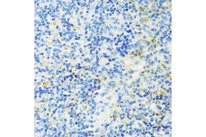 Immunohistochemistry of paraffin-embedded mouse spleen using TIM-3/H antibody (ABIN3016172, ABIN3016173, ABIN3016174, ABIN1680159 and ABIN6219599) at dilution of 1:100 (40x lens). (TIM3 抗体  (AA 22-202))