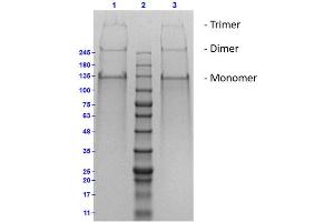 SDS-PAGE (SDS) image for Collagen, Type II, alpha 1 (COL2A1) protein (ABIN5624592)