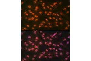 Immunofluorescence analysis of C6 cells using KDM4B/JMJD2B Rabbit mAb (ABIN7268329) at dilution of 1:100 (40x lens).