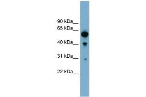 WB Suggested Anti-ARHGAP15 Antibody Titration: 0. (ARHGAP15 抗体  (Middle Region))