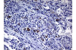 Image no. 1 for anti-Polymerase (DNA Directed) iota (POLI) (AA 458-740) antibody (ABIN1491524) (POLI 抗体  (AA 458-740))