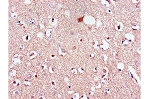 Immunohistochemistry of paraffin-embedded human brain tissue using ABIN7158744 at dilution of 1:100 (LPAR1 抗体  (AA 316-364))