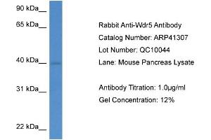 Western Blotting (WB) image for anti-WD Repeat Domain 5 (WDR5) (C-Term) antibody (ABIN2776739) (WDR5 抗体  (C-Term))