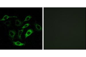 Immunofluorescence analysis of A549 cells, using PTGDR antibody. (PTGDR 抗体)