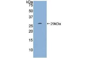 Detection of Recombinant RI, Human using Polyclonal Antibody to Ribonuclease Inhibitor (RI) (RNH1 抗体  (AA 218-444))