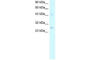 WB Suggested Anti-ACDC Antibody Titration:  5. (ADIPOQ 抗体  (N-Term))
