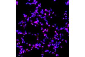 Immunofluorescence (Paraffin-embedded Sections) (IF (p)) image for anti-Survival Motor Neuron Domain Containing 1 (SMNDC1) antibody (ABIN7075773)