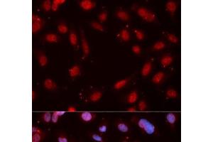 Immunofluorescence analysis of MCF-7 cells using Phospho-CHEK1(S280) Polyclonal Antibody (CHEK1 抗体  (pSer280))