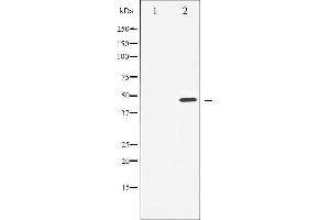 Western blot analysis of Cyclin E1 expression in Paclitaxel treated HeLa whole cell lysates,The lane on the left is treated with the antigen-specific peptide. (Cyclin E1 抗体  (C-Term))