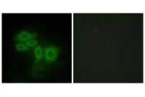 Immunofluorescence analysis of HepG2 cells, using SLK antibody. (SLK 抗体  (C-Term))