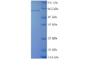 VP6 (AA 1-397), (full length) protein (His-SUMO Tag)